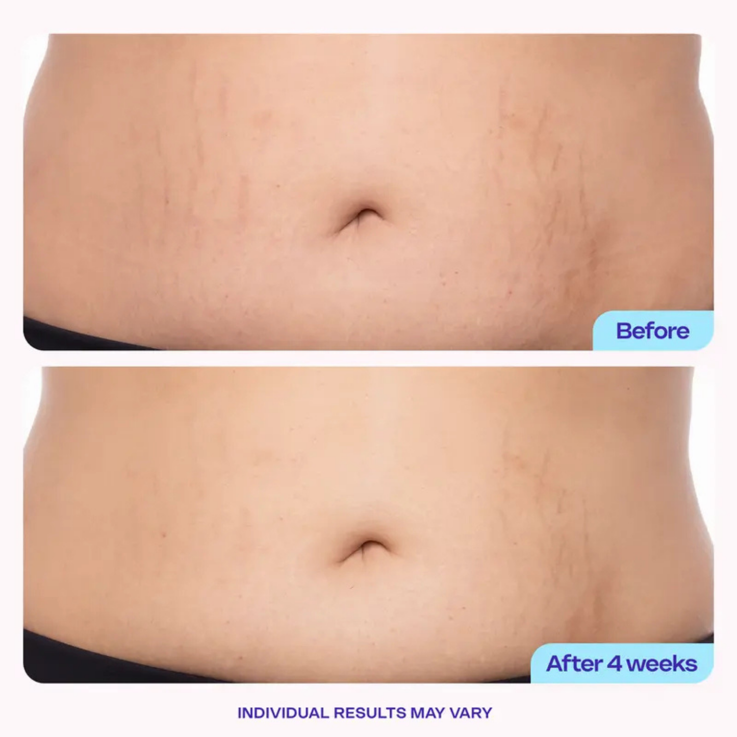 Belly Firming Cream