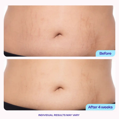 Belly Firming Cream
